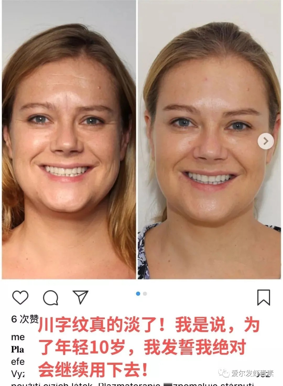 爱尔发虾青素